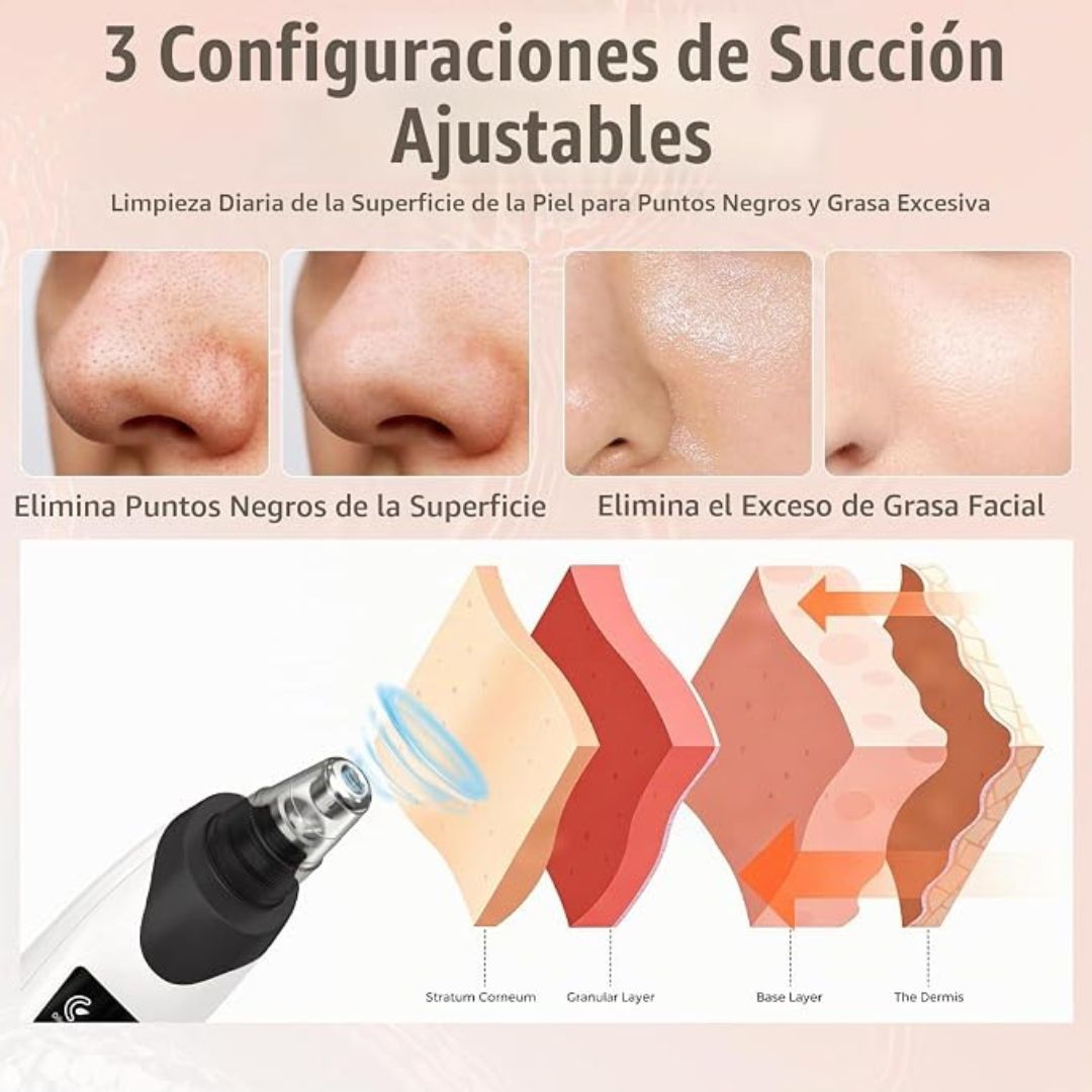 Aspiradora de Poros Removedor de Puntos Negros, Limpiador Facial de Poros